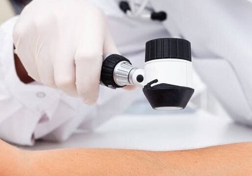 skin checks in Queensland Skin Cancer Clinic
