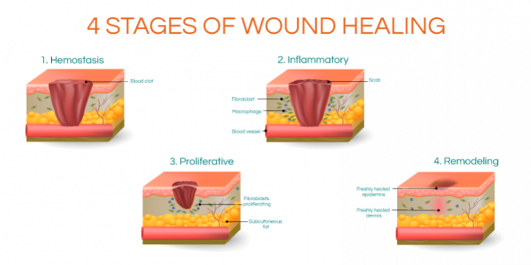 WOUND HEALING